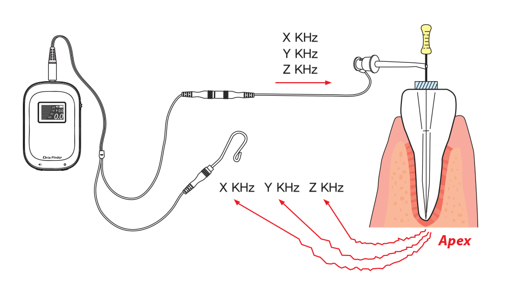 drs finder apex locator